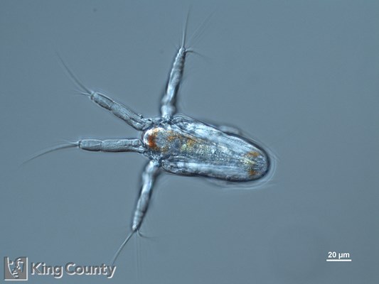 Photo of Copepoda: larval stages
